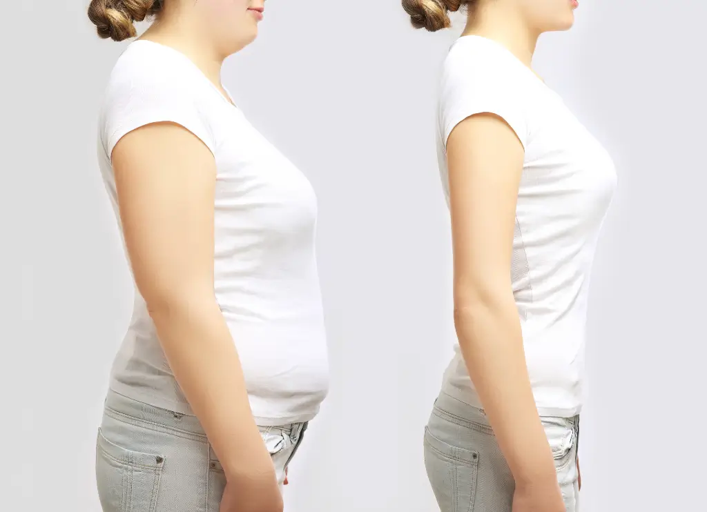 Customized Medical Weight Loss Programs